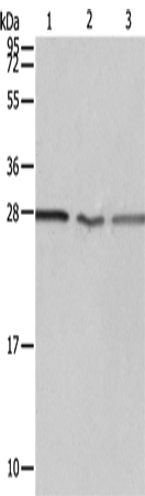 PSMD9 Polyclonal Antibody – Figure 1 of 4