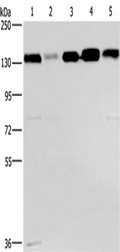 CEP97 Polyclonal Antibody – Figure 1 of 2