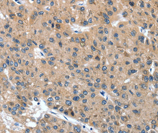 DSC1 Polyclonal Antibody – Figure 1 of 3