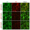 h/m LMOD1 shRNA Lentivirus – Figure 1