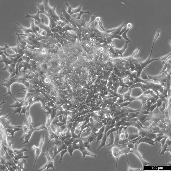 LNCaP clone FGC cell
