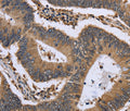 GADD45B Polyclonal Antibody – Figure 1 of 3