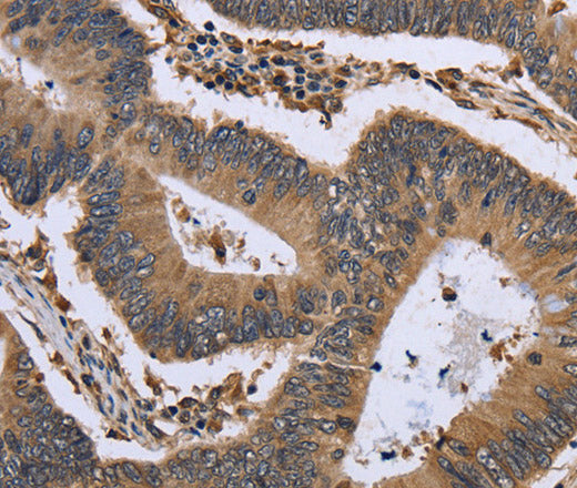 GADD45B Polyclonal Antibody – Figure 1 of 3