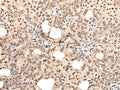 ZSCAN12 Polyclonal Antibody – Figure 1 of 3