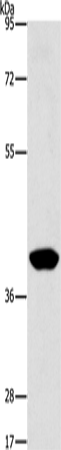PHYKPL Polyclonal Antibody – Figure 1 of 2