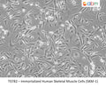 Immortalized Human Skeletal Muscle Cells (SKM-1) | Applied Biological Materials (abm)