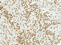 HAS1 Polyclonal Antibody – Figure 1 of 3