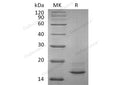 Recombinant Human Calcitonin/CALCA Protein (His Tag) - Figure 1 of 2