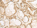 KRR1 Polyclonal Antibody – Figure 1 of 2