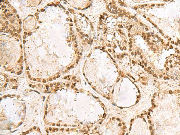 KRR1 Polyclonal Antibody – Figure 1 of 2