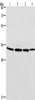 MAD2L1BP Polyclonal Antibody – Figure 1 of 4