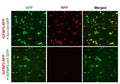 h/m IGFBP2 shRNA Lentivirus – Figure 1