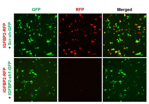 h/m IGFBP2 shRNA Lentivirus – Figure 1