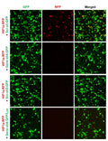 h/m HIF1a shRNA Lentivirus – Figure 1 of 2