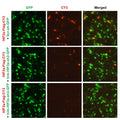 h/m HIF2a shRNA Lentivirus – Figure 1