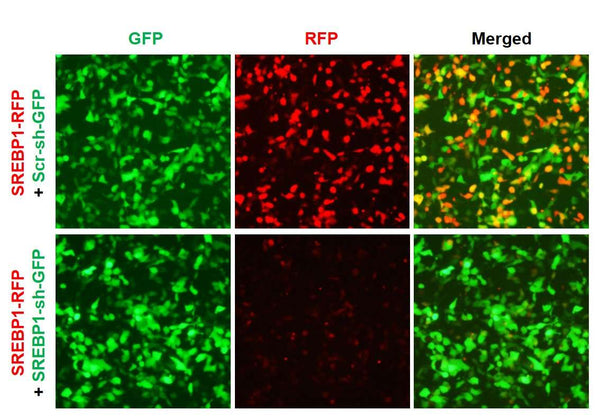 h/m SREBP1 shRNA Lentivirus – Figure 1 of 2