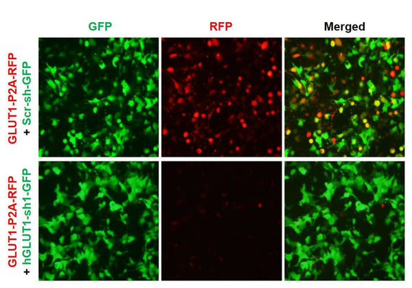 h/m GLUT1 shRNA Lentivirus – Figure 1 of 2
