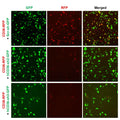 h/m CD36 shRNA Lentivirus – Figure 1 of 4