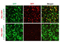 Human PDL1 shRNA Lentivirus – Figure 1