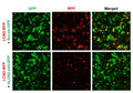 Human LCN2 shRNA Lentivirus – Figure 1 of 2
