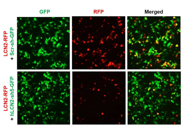 Human LCN2 shRNA Lentivirus – Figure 1 of 2