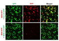 h/m MSN shRNA Lentivirus – Figure 1 of 2