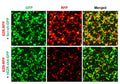 Human EZR shRNA Lentivirus – Figure 1