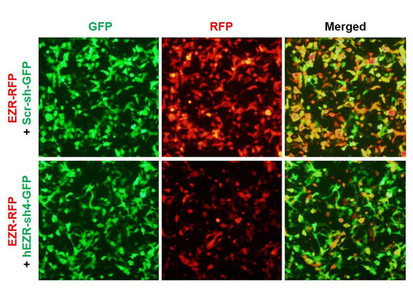 Human EZR shRNA Lentivirus – Figure 1