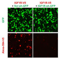 h/m IGF1R shRNA Lentivirus – Figure 1 of 2