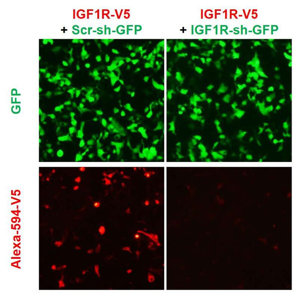 h/m IGF1R shRNA Lentivirus – Figure 1 of 2