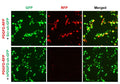 Human PDGFD shRNA Lentivirus – Figure 1