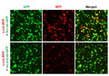 Mouse Lcn2 shRNA Lentivirus – Figure 1