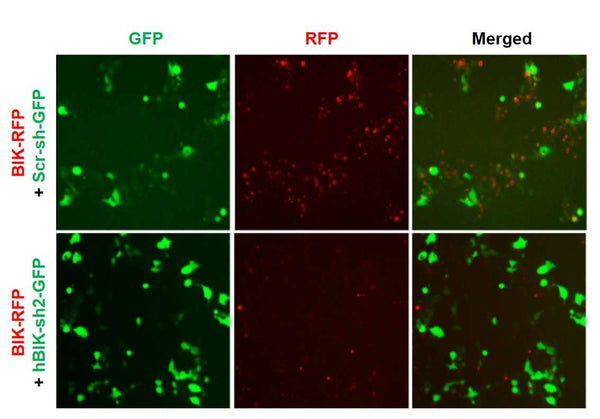 Human BIK shRNA Lentivirus – Figure 1