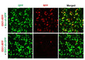 Human IDO1 shRNA Lentivirus – Figure 1 of 2