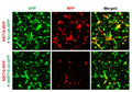 h/m KRT10 shRNA Lentivirus – Figure 1 of 3