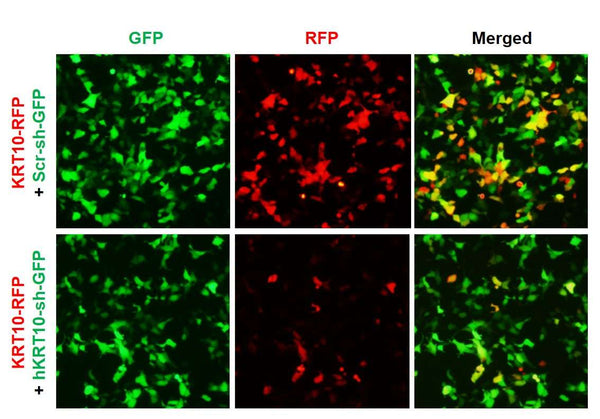 h/m KRT10 shRNA Lentivirus – Figure 1 of 3