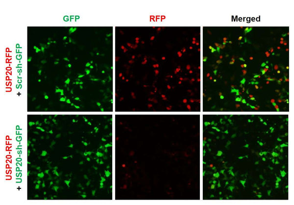 h/m USP20 shRNA Lentivirus – Figure 1 of 2