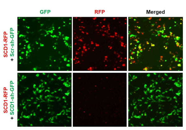 Human/Mouse SCD1 shRNA Lentivirus – Figure 1