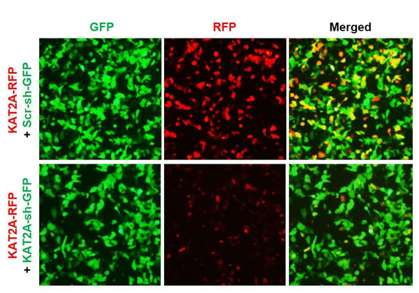h/m KAT2A shRNA Lentivirus – Figure 1