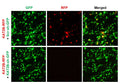 h/m KAT2B shRNA Lentivirus – Figure 1