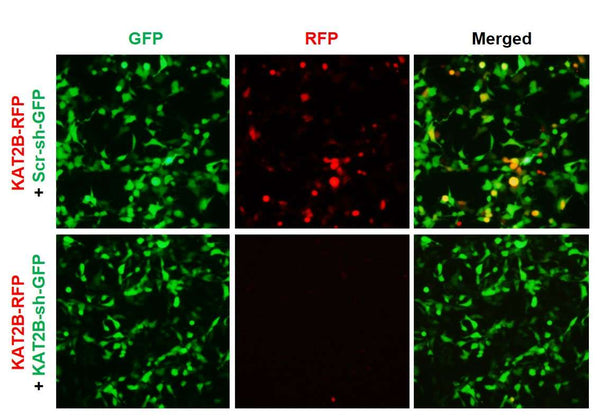 h/m KAT2B shRNA Lentivirus – Figure 1