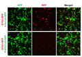 Human GYG1 shRNA Lentivirus – Figure 1