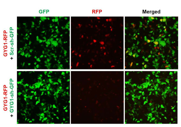 Human GYG1 shRNA Lentivirus – Figure 1