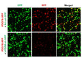 Human PDGFB shRNA Lentivirus – Figure 1 of 2