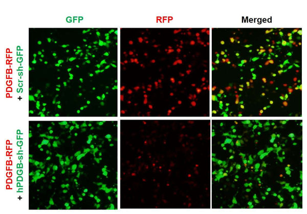 Human PDGFB shRNA Lentivirus – Figure 1 of 2