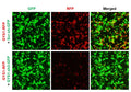 h/m GYS1 shRNA Lentivirus – Figure 1 of 2