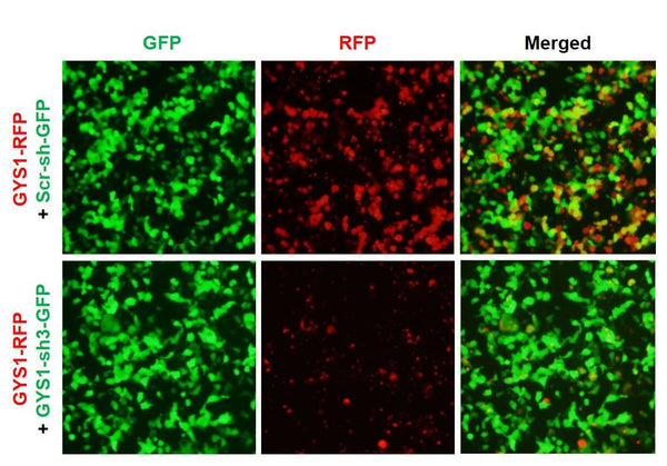 h/m GYS1 shRNA Lentivirus – Figure 1 of 2
