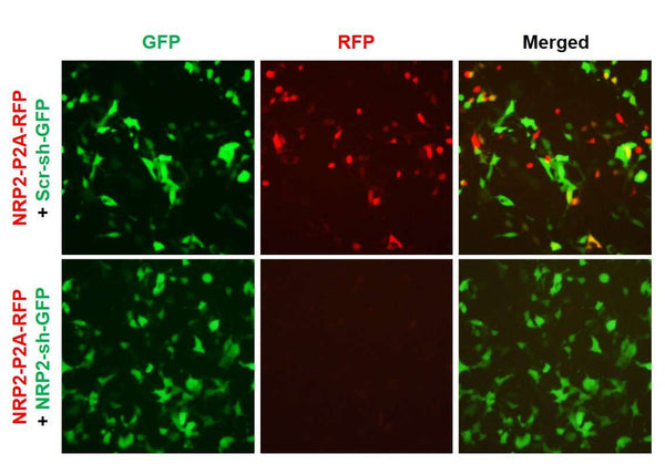 h/m NRP2 shRNA Lentivirus – Figure 1 of 2