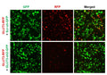 h/m GLUT3 shRNA Lentivirus – Figure 1 of 2