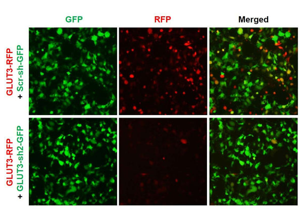 h/m GLUT3 shRNA Lentivirus – Figure 1 of 2